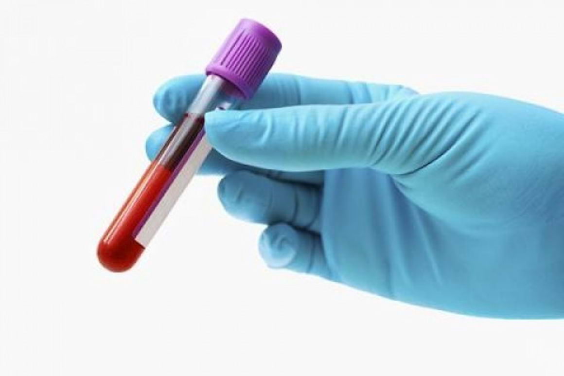 Un nou studiu identifică prevalența globală a genotipurilor hepatitei C 